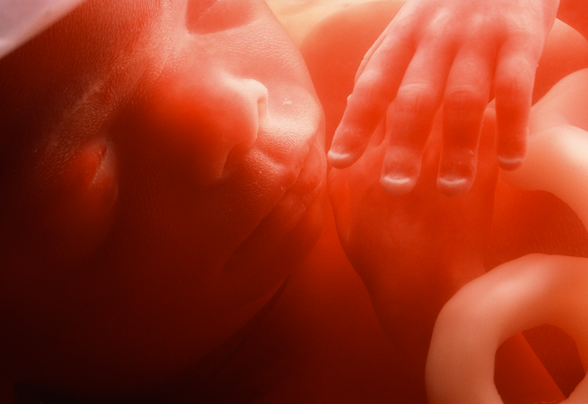 emag4_d1b_face_and_hand_of_a_five_month_old_male_foetus_800.png