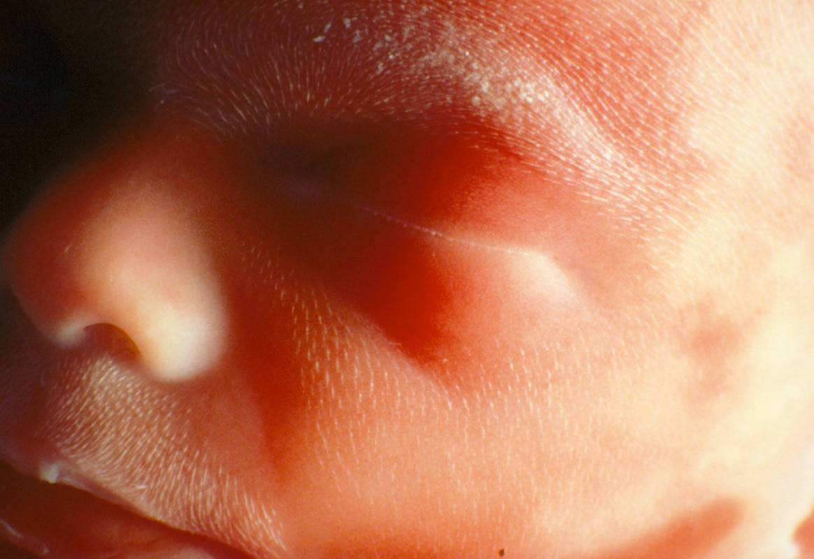 emag4_d1b_face_of_a_male_foetus_at_19_weeks_800.png