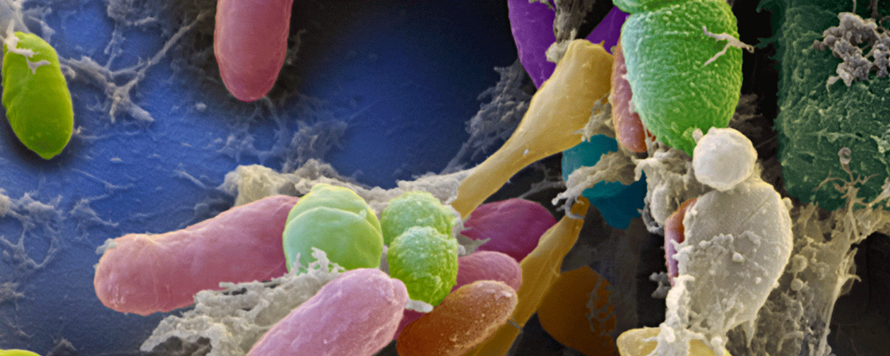 ©Eye of Science_Science Photo Library_C0115043_Faecal_bacteria.png