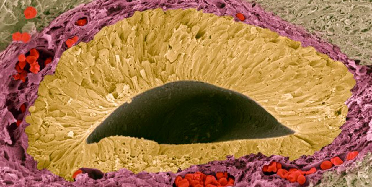 ©Steve Gschmeissner_Science Photo Library_Foetal_sense_organ_F0027306.png