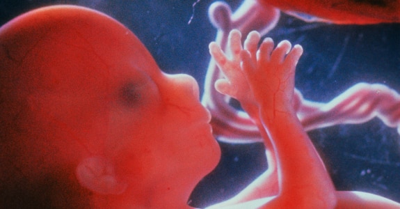 emag4_d1c_foetus_aged_12_weeks_800.png