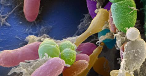 ©Eye of Science_Science Photo Library_C0115043_Faecal_bacteria.png