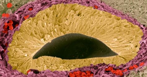 ©Steve Gschmeissner_Science Photo Library_Foetal_sense_organ_F0027306.png